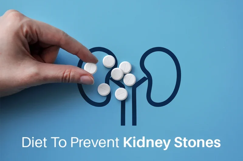 Diet to Prevent Kidney Stones