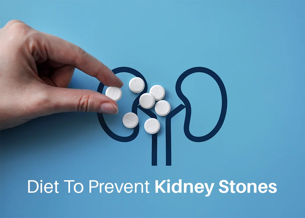 Diet to Prevent Kidney Stones