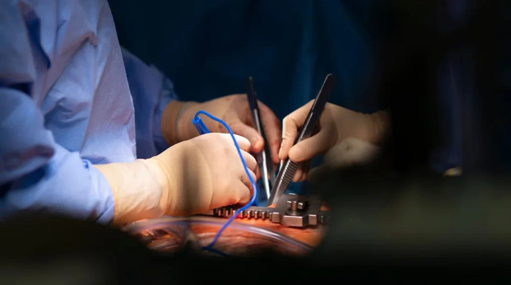 Cardiothoracic Surgery