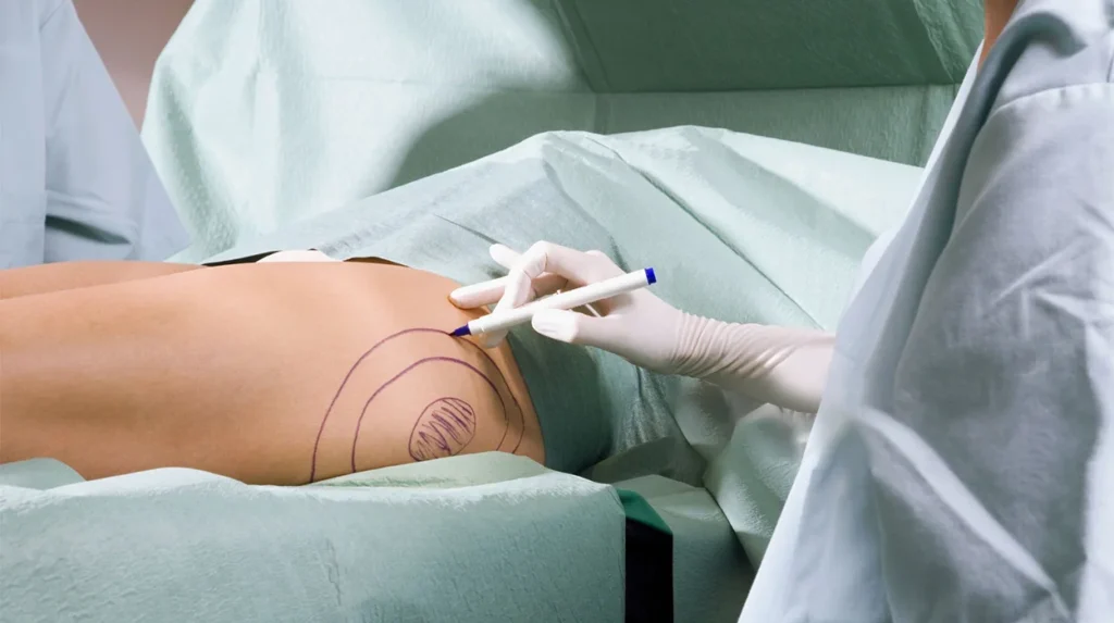 Plastic Surgery