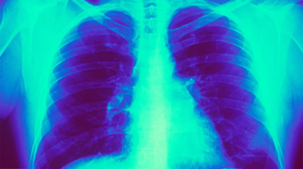 Respiratory Medicine